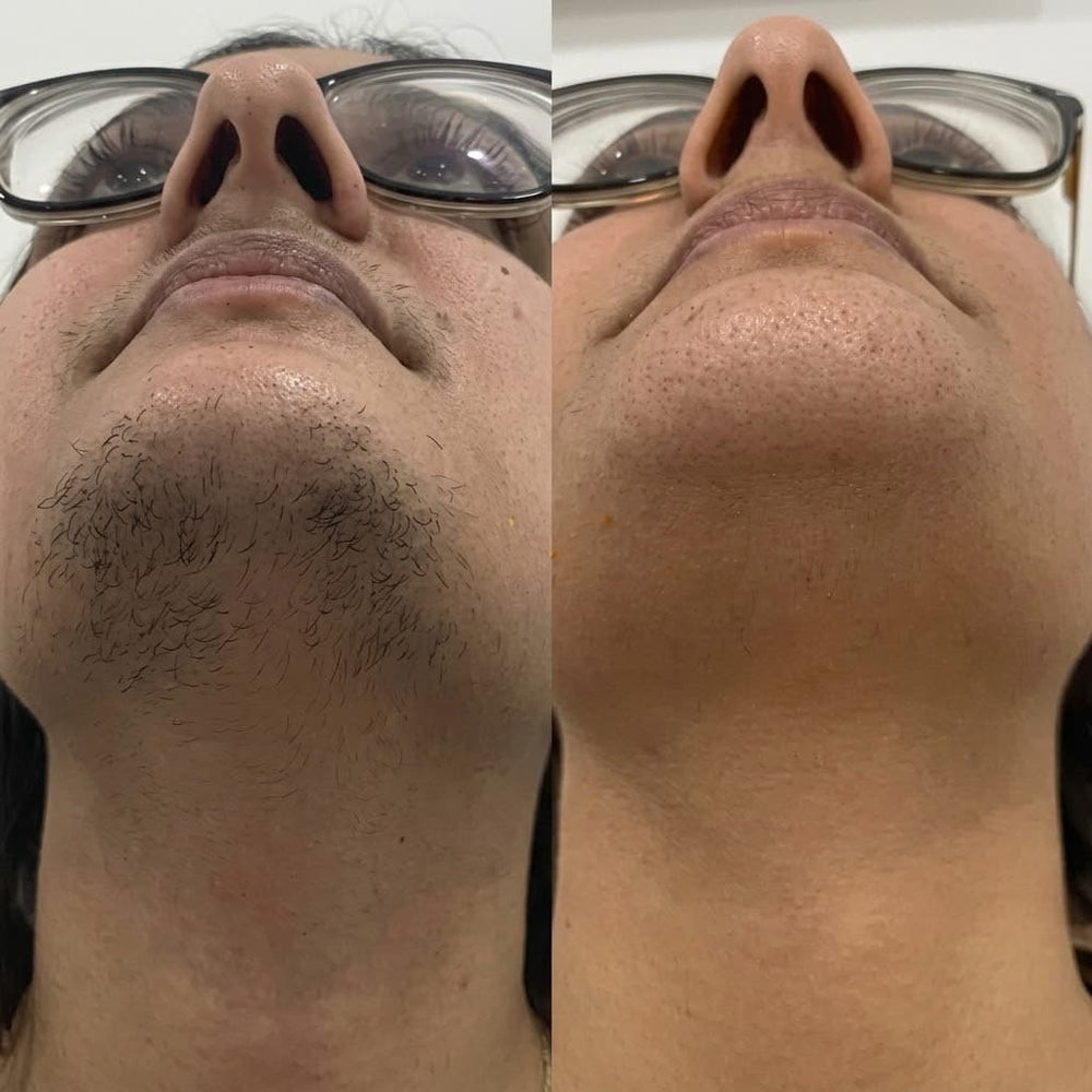 Prima e dopo — recensione cliente Viareline