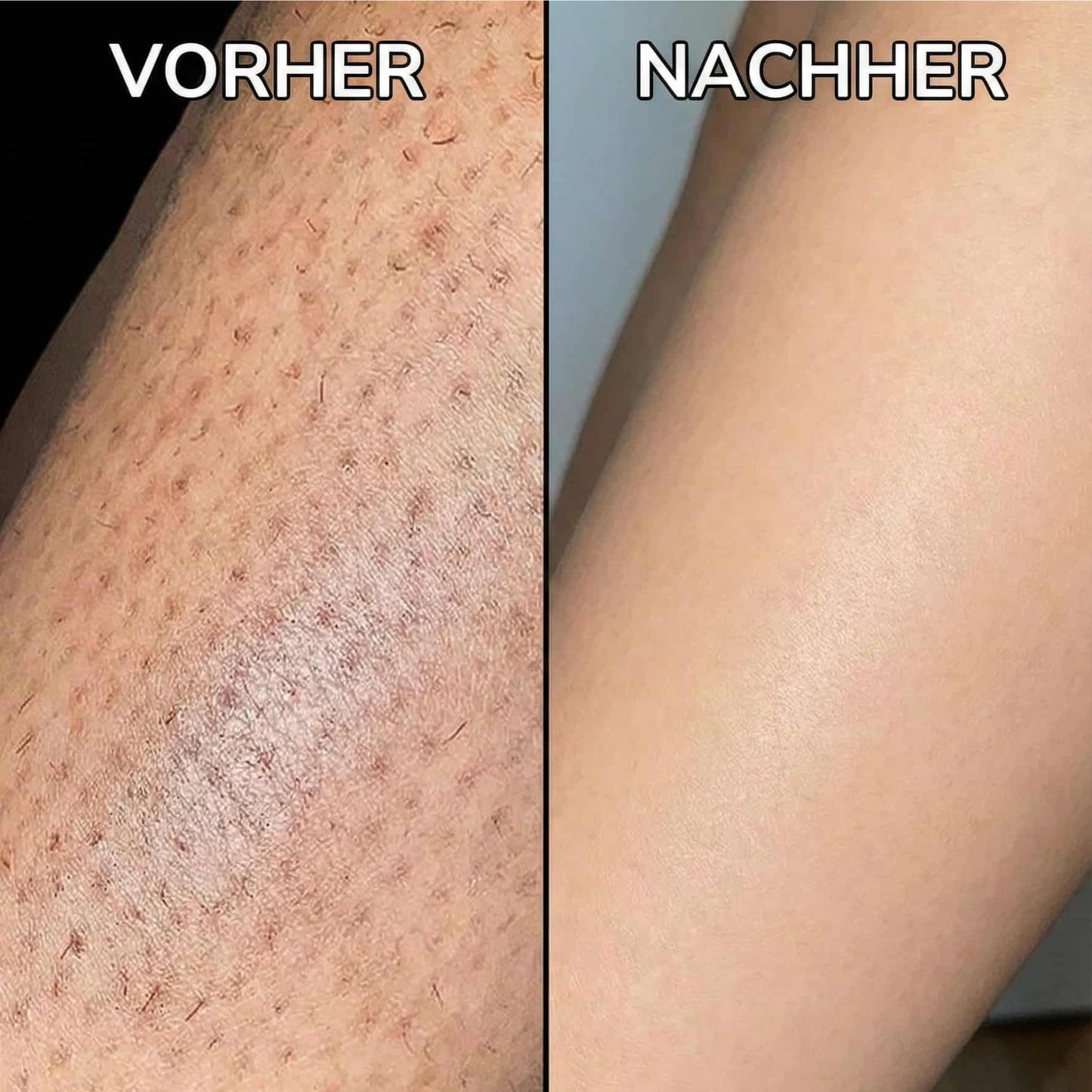 Pflanzlicher Haarwuchsstopp