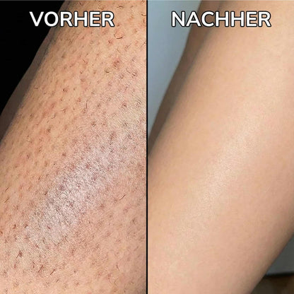 Pflanzlicher Haarwuchsstopp